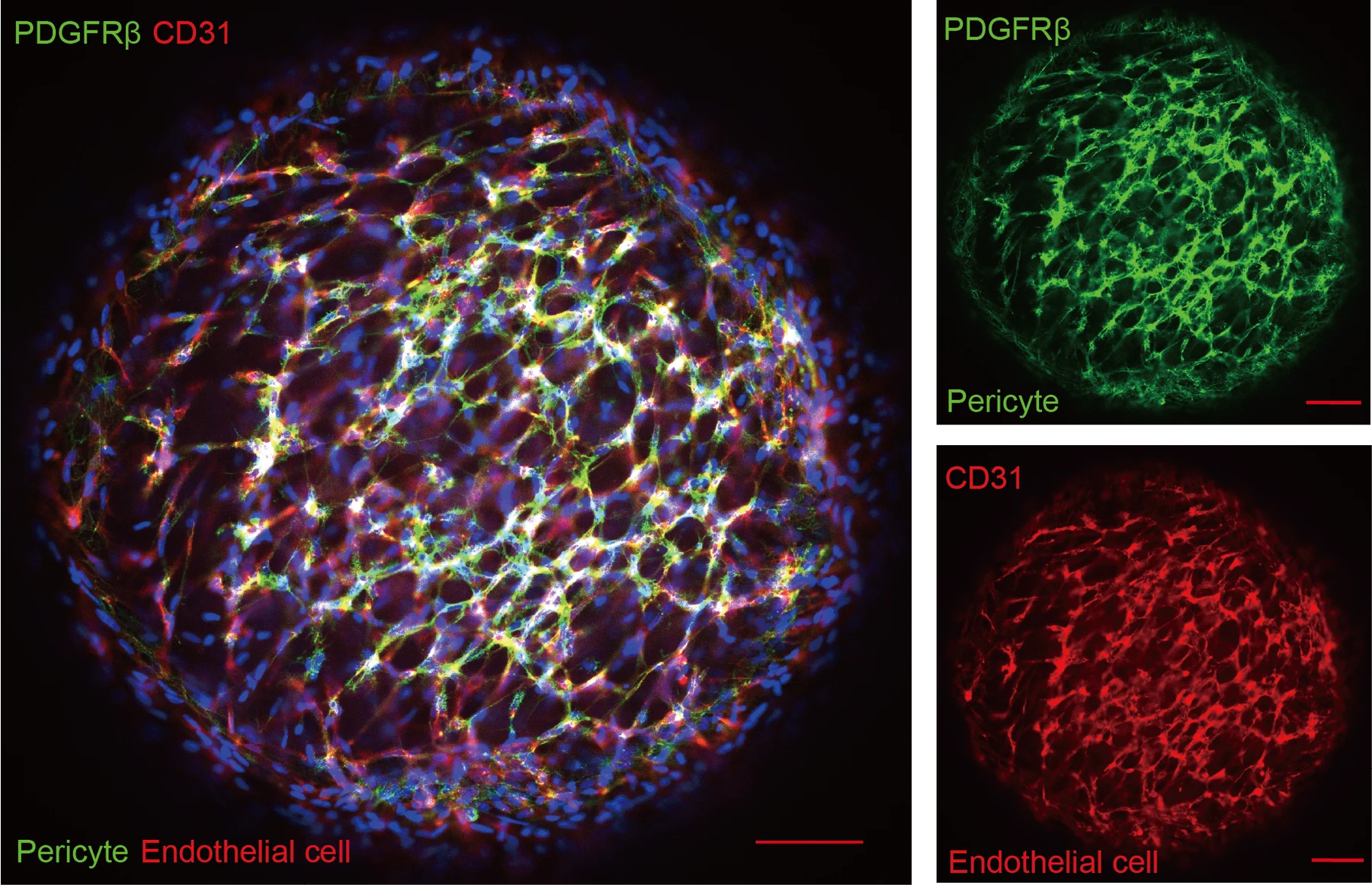 血管 IF:CD31 + PDGFR,100 μm