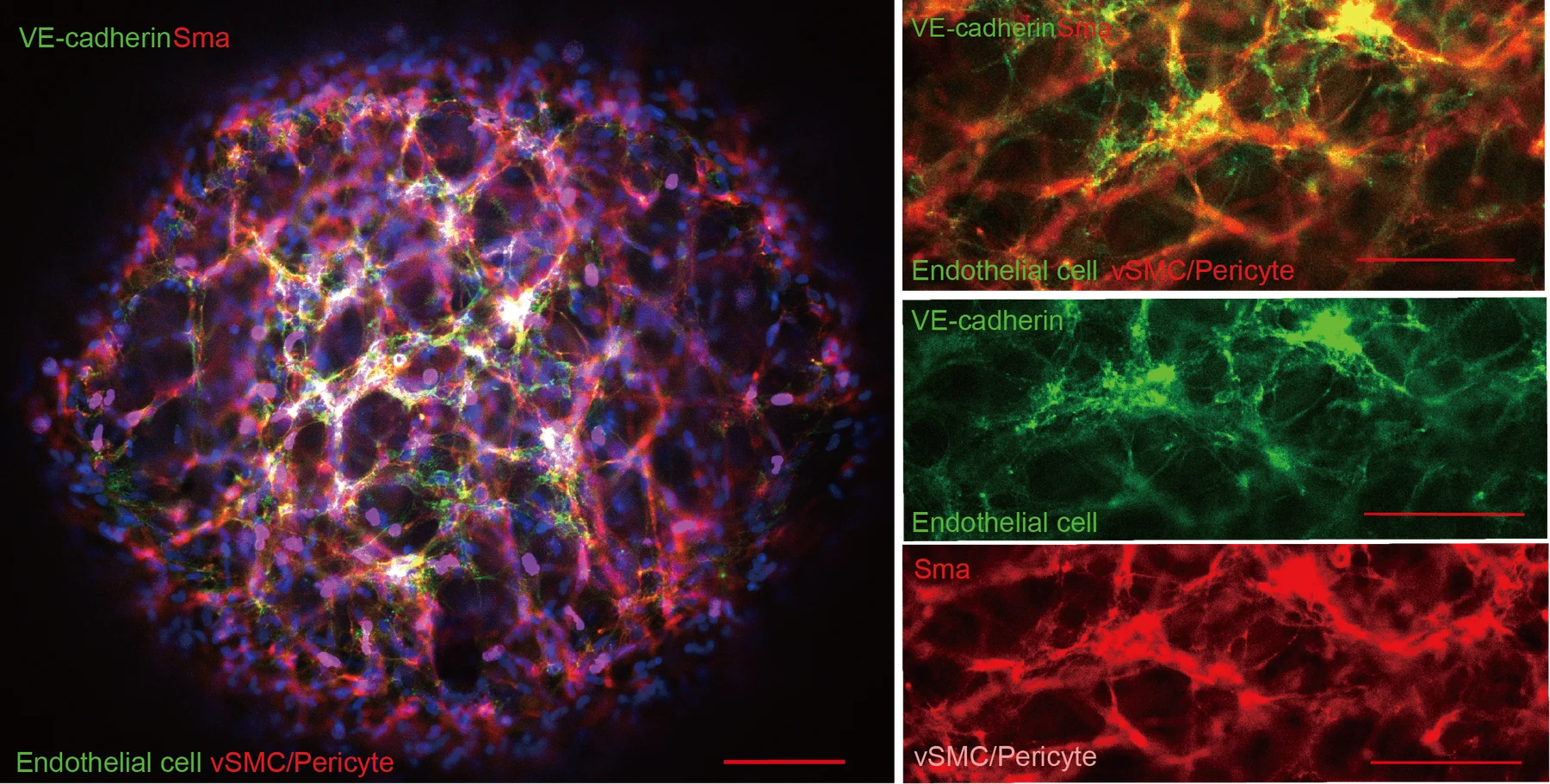 血管 IF:VE-cadherin + SMA,100 μm