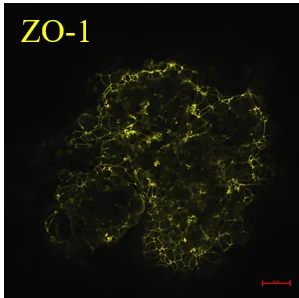 ZO-1